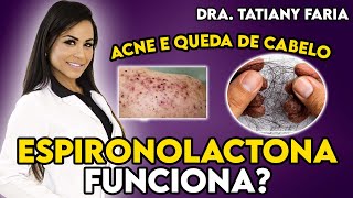 ESPIRONOLACTONA ACNE E QUEDA DE CABELO [upl. by Haidabez]