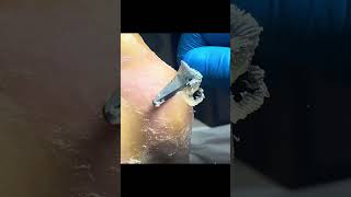 Charming Pedicure Video  Remove Dead Skin [upl. by Knobloch141]