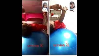 Online physiotherapy started for a 1yearold baby 2 months ago for rightsided Erbs palsy [upl. by Anilahs]