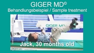 GIGER MD® neurophysiological therapy  Sample treatment [upl. by Hijoung212]