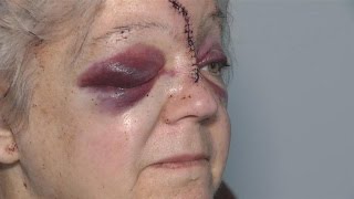 Woman With Cancer Brutally Beaten With Hammer While Trying to Save CoWorker [upl. by Aisena]