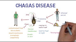 Chagas Disease  An overview [upl. by Bary295]