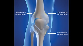 GENICULAR NERVE BLOCK [upl. by Nnylirehs139]