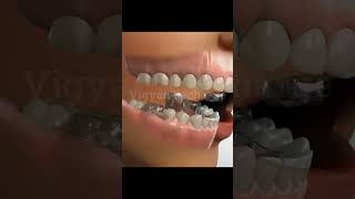 Jaw Treatment teeth dentist health [upl. by Erotavlas]