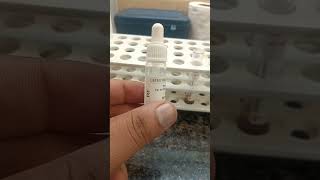 RA Factor Test कैसे करें laboratory pathologylab pathology lab viralshort viarlvideo viral [upl. by Sterne486]