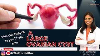 This Can Happen to you If you have A Large Ovarian Cyst  TheFibroidDoc  Dr Cheruba Prabakar [upl. by Nolrak]