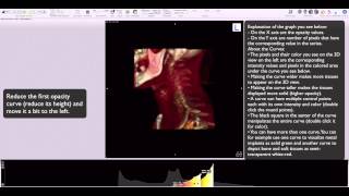 Osirix 16bit clut editor in 3D view [upl. by Ariaes]