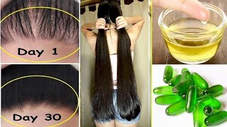 VitaminE Capsule For Fast Hair GrowthHow To use Vitamin E For Hair GrowthHair Growth [upl. by Gnok681]