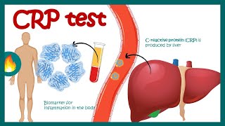 CReactive Protein CRP  Inflammation  Acute phase reactant  How do you read CRP test results [upl. by Hgieleak500]