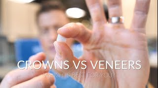 CROWNS VS VENEERS  Which is best [upl. by Aracaj]