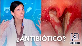 ¿Por qué NO tomar antibiótico  RESISTENCIA ANTIMICROBIANA Salud en Corto [upl. by Eileek]