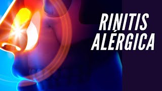 ¿Qué es la rinitis alérgica síntomas tratamiento diagnóstico y prevención alergia nasal [upl. by Rondi451]