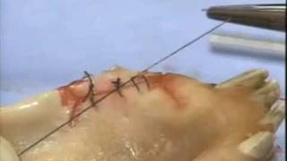 Introduction to Periodontal Surgery Techniques Initial Incisions and Suturing [upl. by Booze]