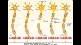 Wallerian degeneration in nerves Causes and Manifestations [upl. by Ahsimot487]