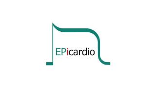 Epicardio Simulation™ LBBB [upl. by Chara]