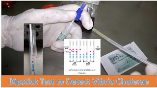 Vibrio cholerae Rapid Diagnostic Test Procedure for Serotypes O1 and O139 [upl. by Lekzehcey872]