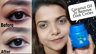 Remove Dark Circles Permanently in 1 day with Coconut oil 100 Effective  Nisha GorgQueen [upl. by Eelamme862]