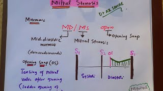 Mitral Stenosis Concepts and mcqs [upl. by Irwinn]