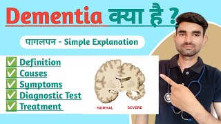 Dementia in Hindi  Causes Symptoms And Treatment of Dementia [upl. by Anilok]