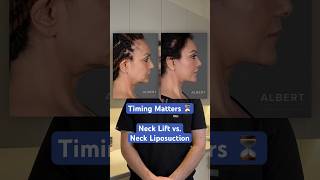 Neck Lift vs Neck Liposuction— Timing Matters ⏳ [upl. by Enomas]