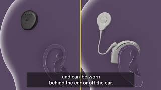 How Cochlear Implants Work [upl. by Irej]