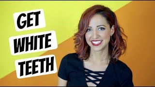 Best Teeth Whitening Options [upl. by Markos]