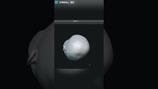 iReal M3 3D Scanning For Baby Head Assessment and Correction [upl. by Love]