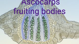 Ascocarps sexual fruiting bodies of ascomycota [upl. by Clough]