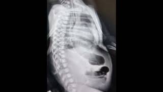 Newborn Xray l Abdominal Xray l Pause review comment nicu [upl. by Nitza]