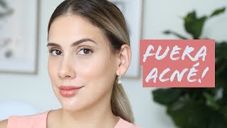 Tips mascarillas y productos no invasivos para el acne  Carolina Ortiz [upl. by Amrak]