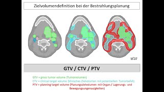 Zielvolumendefinition bei der Bestrahlungsplanung Teil1  Strahlentherapie Prof Hilke Vorwerk [upl. by Shepp]