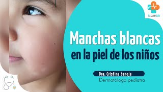 Manchas blancas en la piel de los niños  Tu Salud Guía [upl. by Rovert]