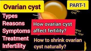 ovarian cyst pregnancy and ovarian cyst ಕನ್ನಡ infertility due to ovarian cyst  PART1 [upl. by Accebber]