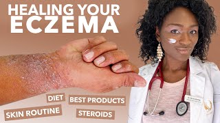 How to Treat ECZEMAAtopic Dermatitis Black Dark Skin Dry Flaky Skincare Routine Hyperpigmentation [upl. by Htor211]