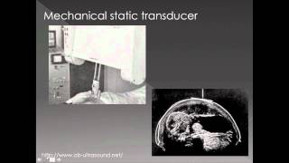 Ultrasound Physics 3  Beam Formation and Transducers [upl. by Schuman935]