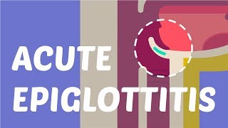 What is Acute Epiglottitis [upl. by Aibun645]