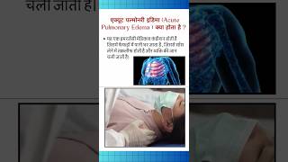 Acute pulmonary edema क्या है फेफड़ों में पानी भरने से जा सकती है जान [upl. by Duile]