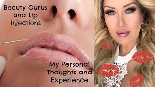 MY LIP INJECTION EXPERIENCE  Why So Many Beauty Youtubers Get Them [upl. by Valencia]