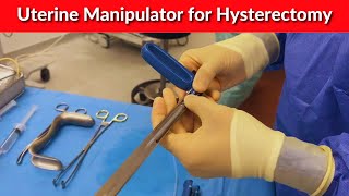 Uterine Manipulator for Hysterectomy  Dr Kunal Rathod [upl. by Rosalinde]