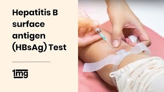 Hepatitis B Titer  Hep B Surface Antibody Test Results Overview [upl. by Patterson273]