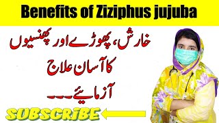 Benefits Of Anaab  Ziziphus JuJuba  Treatment  By Doctor Asbah [upl. by Naaitsirhc]