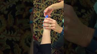 Serial Splinting for Finger Contractures [upl. by Elnora106]