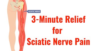 3 of the Best Exercises for Relief of Sciatic Nerve Pain With FREE Exercise Sheet [upl. by Lisette826]