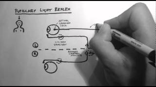 Reflexes 2  Pupillary Light Reflex [upl. by Adneral]