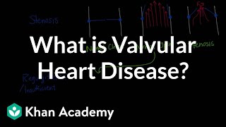 What is valvular heart disease  Circulatory System and Disease  NCLEXRN  Khan Academy [upl. by Yesrod]