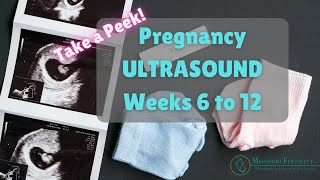 Take a Peek Weeks 6 to 12 in Pregnancy Scans  Ultrasounds [upl. by Rust]