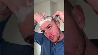 Keep falling in love hair hairtransformation hairtransplant hairwashday update buzzcut [upl. by Elfrieda]