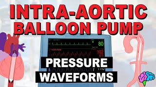 IABP Waveforms amp Pressures EXPLAINED [upl. by Eidarb]