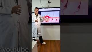 Pilonidal Sinus Explained  Causes amp Relief in 30 Seconds  Elegance Clinic  Surat [upl. by Lemay282]