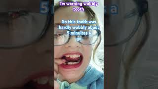 TW WOBBLY TOOTH [upl. by Frasquito333]